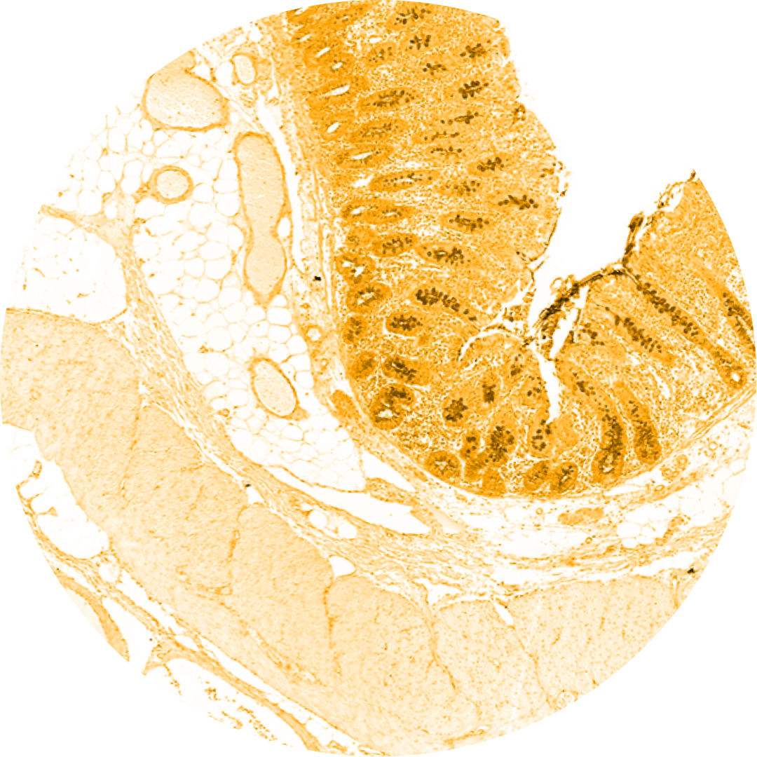 Sungold Apricot Histology